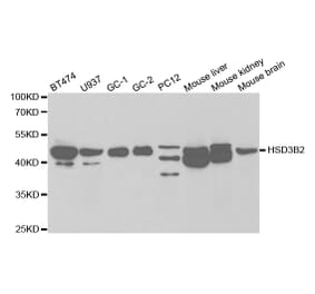 Western blot - HSD3B2 Antibody from Signalway Antibody (32452) - Antibodies.com