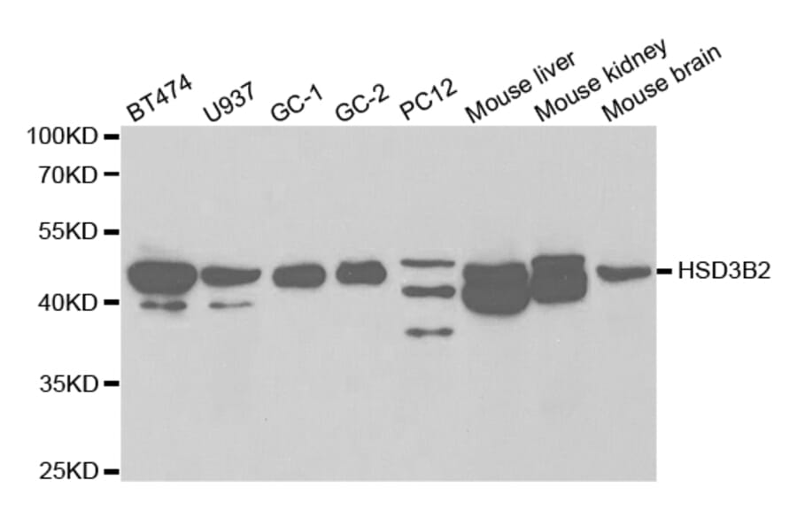Western blot - HSD3B2 Antibody from Signalway Antibody (32452) - Antibodies.com