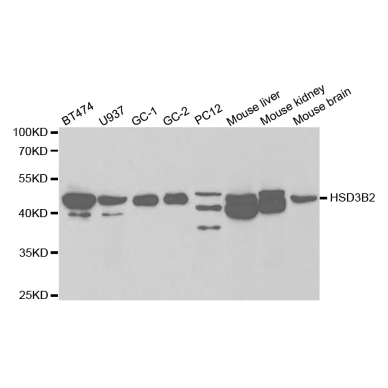 Western blot - HSD3B2 Antibody from Signalway Antibody (32452) - Antibodies.com