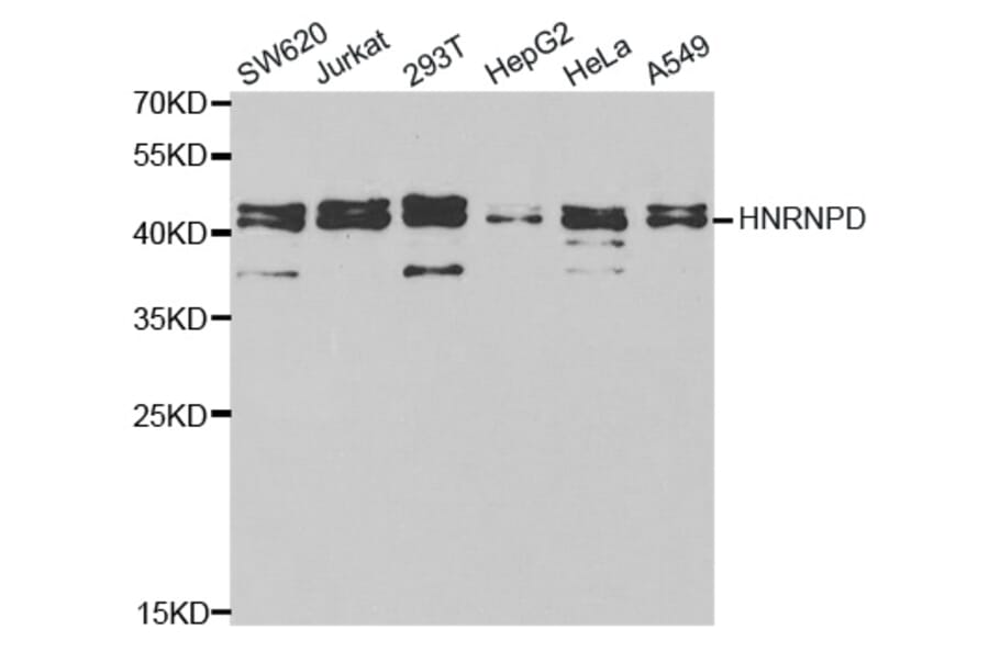 Western blot - HNRNPD Antibody from Signalway Antibody (32455) - Antibodies.com