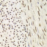 Immunohistochemistry - HNRNPD Antibody from Signalway Antibody (32455) - Antibodies.com