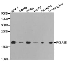 Western blot - POLR2D Antibody from Signalway Antibody (32475) - Antibodies.com