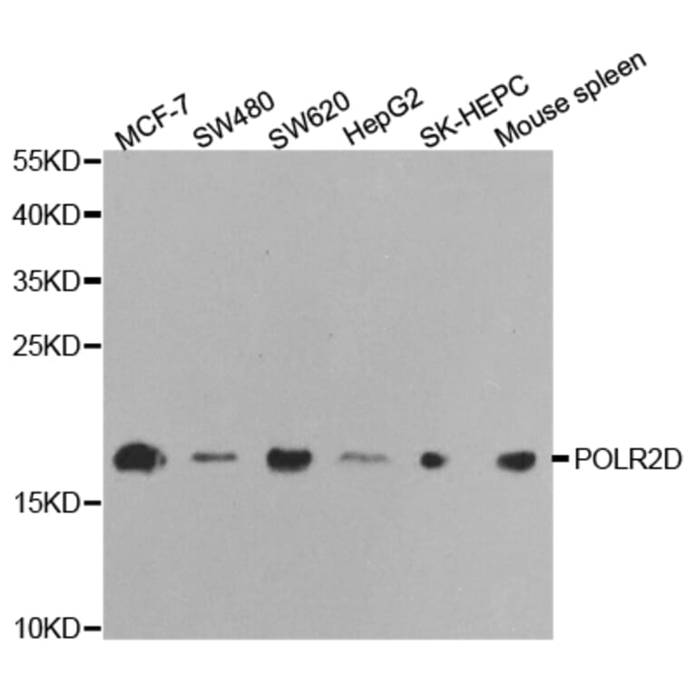 Western blot - POLR2D Antibody from Signalway Antibody (32475) - Antibodies.com