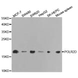 Western blot - POLR2D Antibody from Signalway Antibody (32475) - Antibodies.com