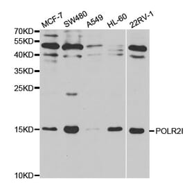 Western blot - POLR2I Antibody from Signalway Antibody (32479) - Antibodies.com
