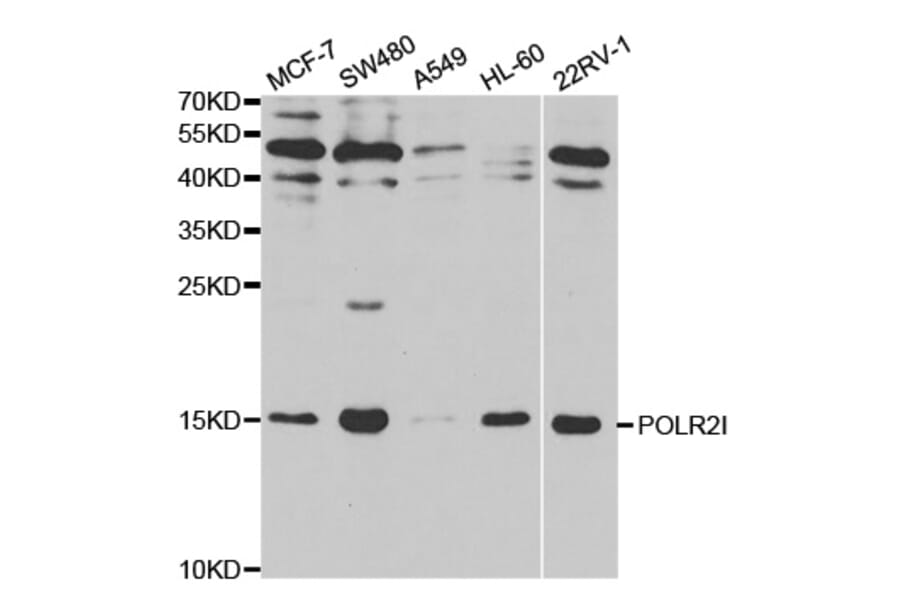 Western blot - POLR2I Antibody from Signalway Antibody (32479) - Antibodies.com