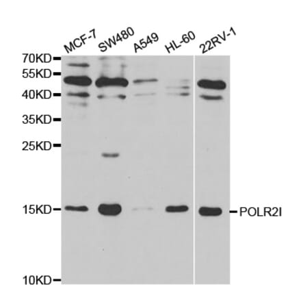 Western blot - POLR2I Antibody from Signalway Antibody (32479) - Antibodies.com