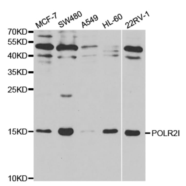 Western blot - POLR2I Antibody from Signalway Antibody (32479) - Antibodies.com