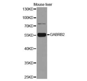 Western blot - GABRB2 Antibody from Signalway Antibody (32483) - Antibodies.com