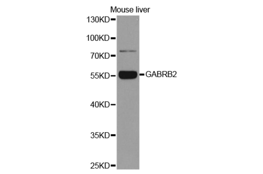 Western blot - GABRB2 Antibody from Signalway Antibody (32483) - Antibodies.com