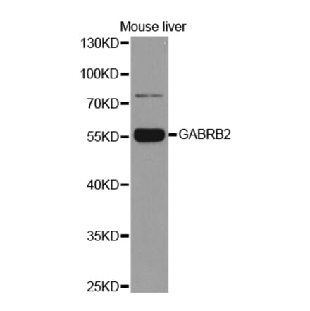 Western blot - GABRB2 Antibody from Signalway Antibody (32483) - Antibodies.com