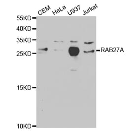 Western blot - RAB27A Antibody from Signalway Antibody (32507) - Antibodies.com