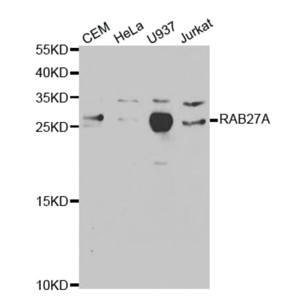 Western blot - RAB27A Antibody from Signalway Antibody (32507) - Antibodies.com