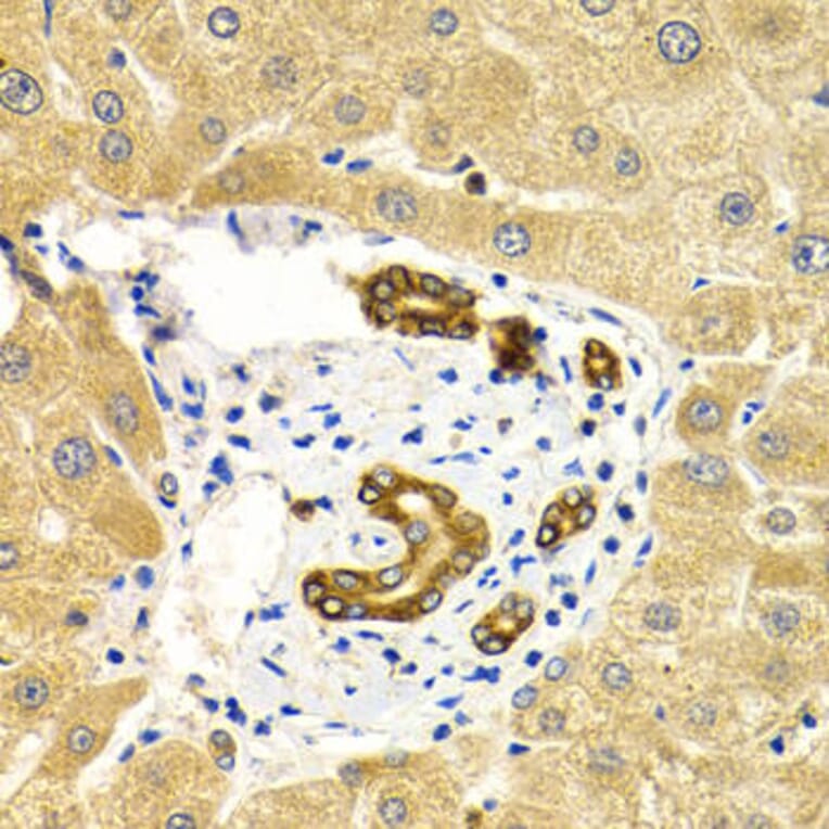 Immunohistochemistry - RAB27A Antibody from Signalway Antibody (32507) - Antibodies.com