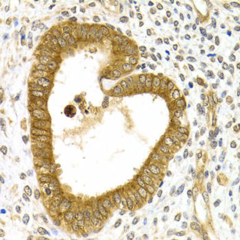 Immunohistochemistry - RAB27A Antibody from Signalway Antibody (32507) - Antibodies.com