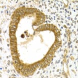 Immunohistochemistry - RAB27A Antibody from Signalway Antibody (32507) - Antibodies.com