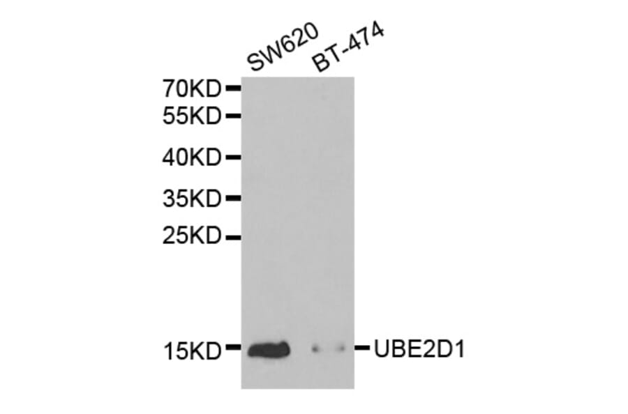 Western blot - UBE2D1 Antibody from Signalway Antibody (32518) - Antibodies.com