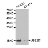 Western blot - UBE2D1 Antibody from Signalway Antibody (32518) - Antibodies.com