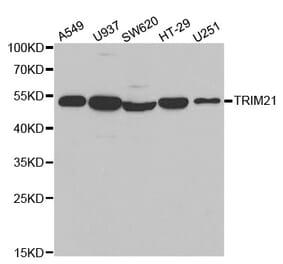 Western blot - TRIM21 Antibody from Signalway Antibody (32520) - Antibodies.com