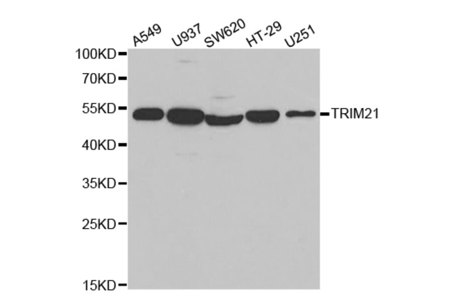 Western blot - TRIM21 Antibody from Signalway Antibody (32520) - Antibodies.com