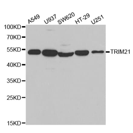 Western blot - TRIM21 Antibody from Signalway Antibody (32520) - Antibodies.com