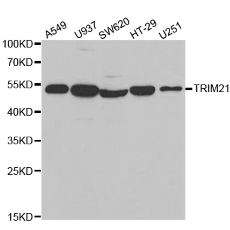 Western blot - TRIM21 Antibody from Signalway Antibody (32520) - Antibodies.com