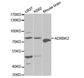 Western blot - ADRBK2 Antibody from Signalway Antibody (32570) - Antibodies.com