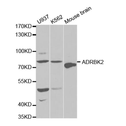 Western blot - ADRBK2 Antibody from Signalway Antibody (32570) - Antibodies.com