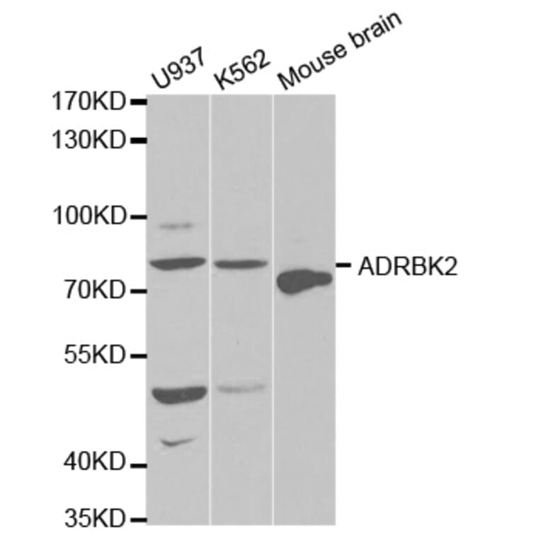 Western blot - ADRBK2 Antibody from Signalway Antibody (32570) - Antibodies.com