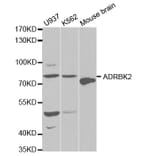 Western blot - ADRBK2 Antibody from Signalway Antibody (32570) - Antibodies.com