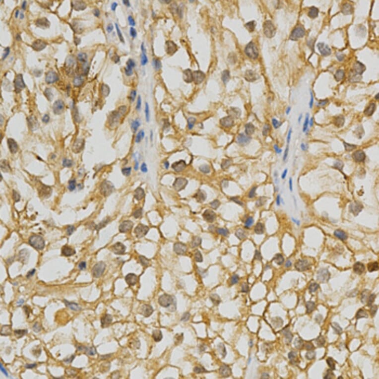 Immunohistochemistry - ADRBK2 Antibody from Signalway Antibody (32570) - Antibodies.com