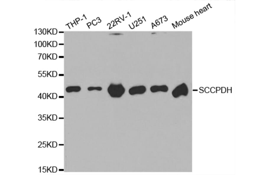 Western blot - SCCPDH Antibody from Signalway Antibody (32625) - Antibodies.com