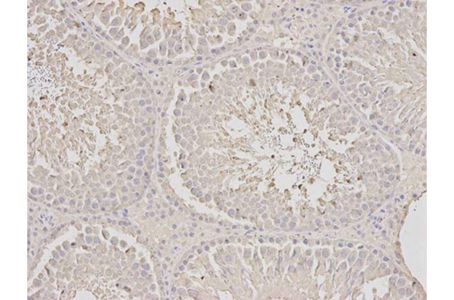 Immunohistochemistry - SCCPDH Antibody from Signalway Antibody (32625) - Antibodies.com