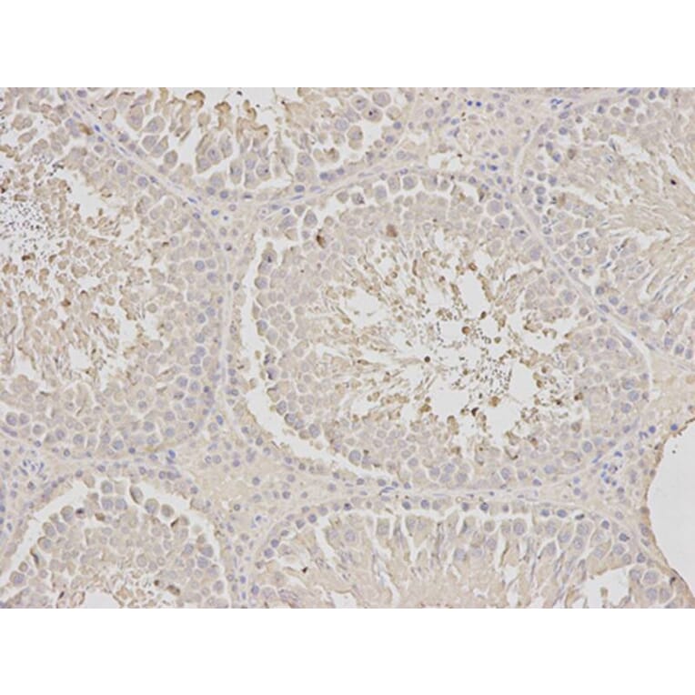 Immunohistochemistry - SCCPDH Antibody from Signalway Antibody (32625) - Antibodies.com