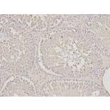 Immunohistochemistry - SCCPDH Antibody from Signalway Antibody (32625) - Antibodies.com