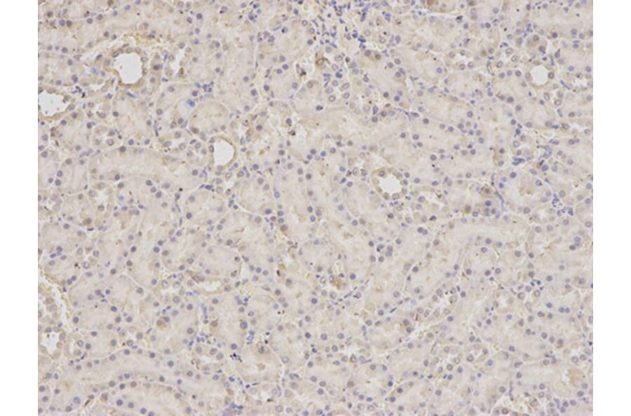 Immunohistochemistry - SCCPDH Antibody from Signalway Antibody (32625) - Antibodies.com