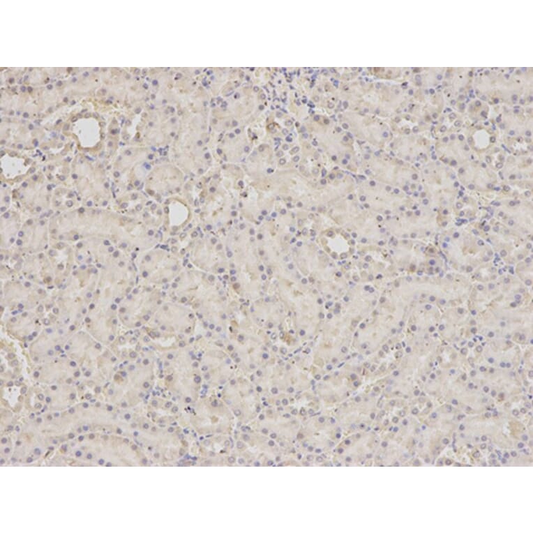Immunohistochemistry - SCCPDH Antibody from Signalway Antibody (32625) - Antibodies.com