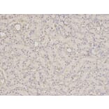 Immunohistochemistry - SCCPDH Antibody from Signalway Antibody (32625) - Antibodies.com