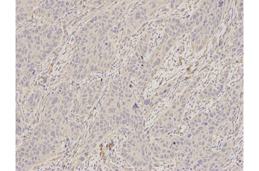 Immunohistochemistry - SCCPDH Antibody from Signalway Antibody (32625) - Antibodies.com