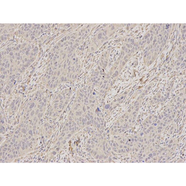 Immunohistochemistry - SCCPDH Antibody from Signalway Antibody (32625) - Antibodies.com