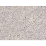 Immunohistochemistry - SCCPDH Antibody from Signalway Antibody (32625) - Antibodies.com