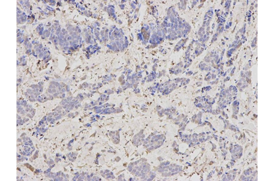 Immunohistochemistry - SCCPDH Antibody from Signalway Antibody (32625) - Antibodies.com