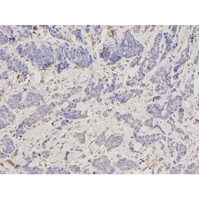 Immunohistochemistry - SCCPDH Antibody from Signalway Antibody (32625) - Antibodies.com