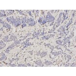 Immunohistochemistry - SCCPDH Antibody from Signalway Antibody (32625) - Antibodies.com