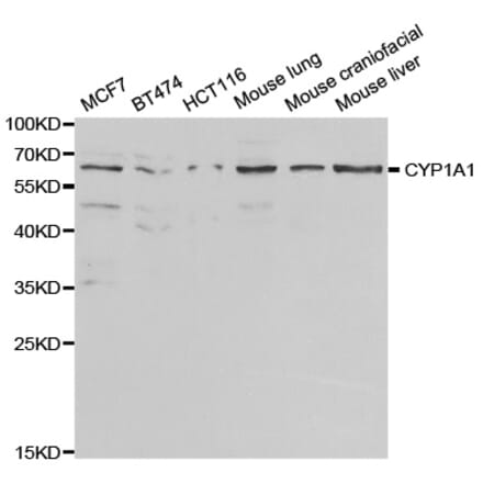 Western blot - CYP1A1 Antibody from Signalway Antibody (32629) - Antibodies.com