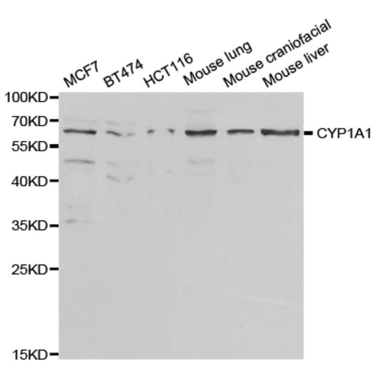 Western blot - CYP1A1 Antibody from Signalway Antibody (32629) - Antibodies.com