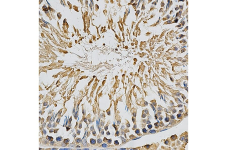 Immunohistochemistry - CYP1A1 Antibody from Signalway Antibody (32629) - Antibodies.com