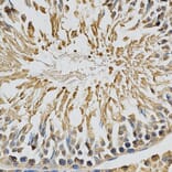 Immunohistochemistry - CYP1A1 Antibody from Signalway Antibody (32629) - Antibodies.com