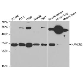 Western blot - HAVCR2 Antibody from Signalway Antibody (32686) - Antibodies.com