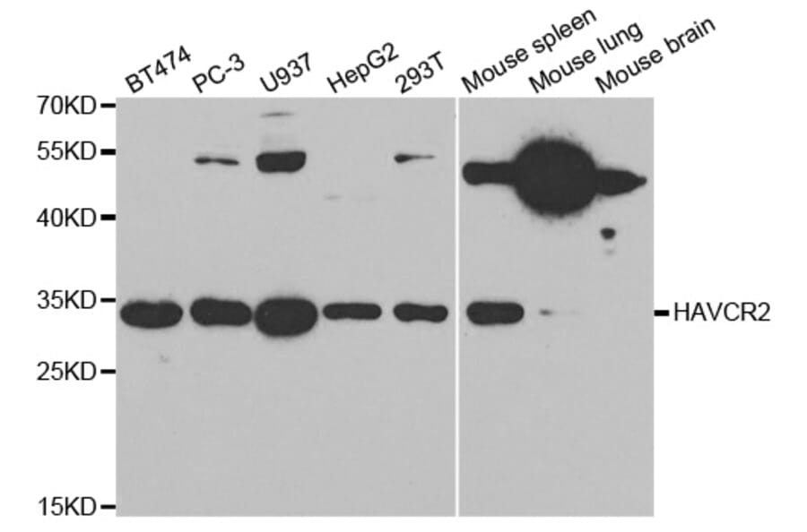Western blot - HAVCR2 Antibody from Signalway Antibody (32686) - Antibodies.com